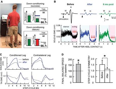 Enhancing neurorehabilitation by targeting beneficial plasticity